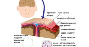 Менингит – инфекционное воспаление мозговых оболочек головного и спинного мозга