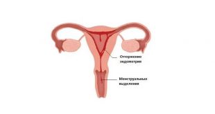 Как менструация влияет на здоровье организма у девушки-женщины